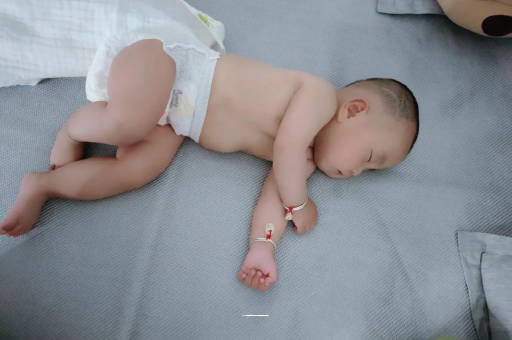 宁阳宝宝头上长痱子